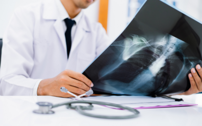 Göğüs Hastalıkları